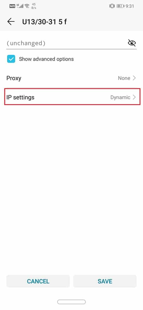 Select IP settings