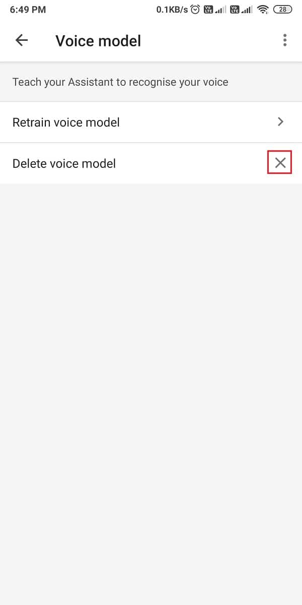 tap on the cross next to 'delete voice model' to remove it. 